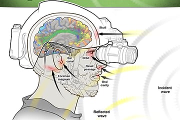 brain-injuries-research